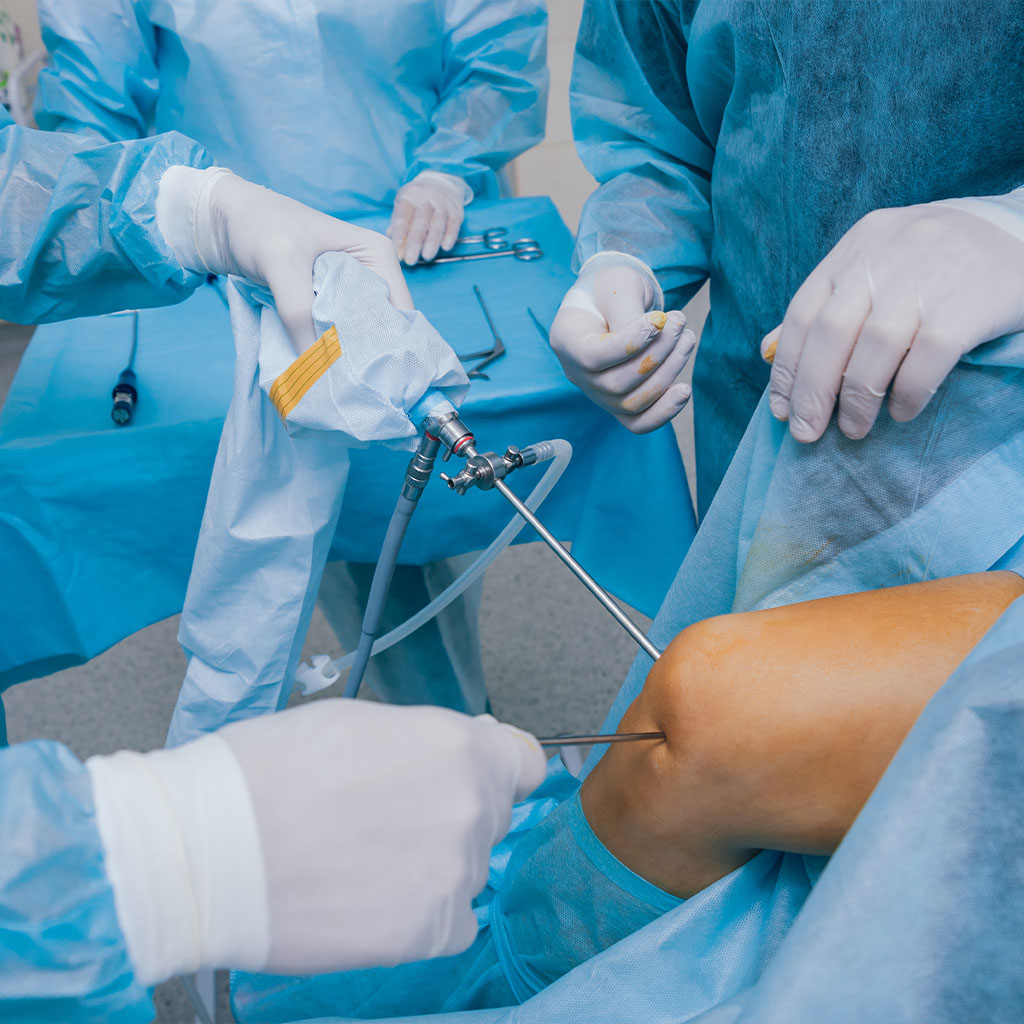 Arthroscopic Surgery – Fibo Health