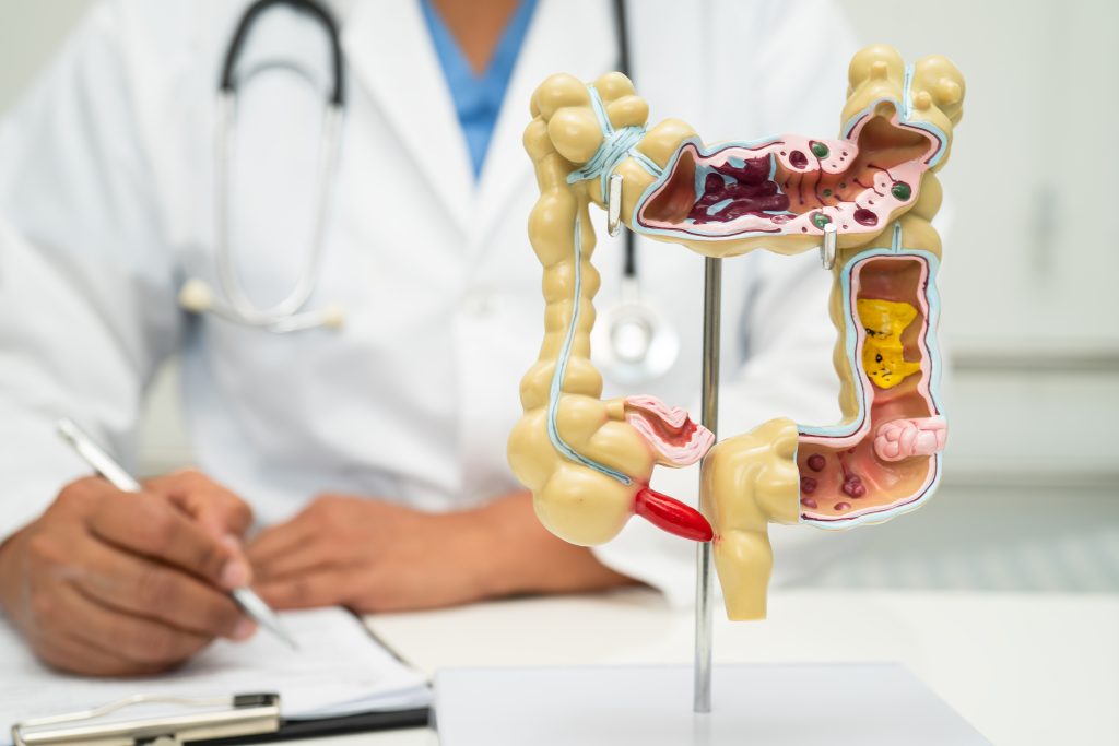 Intestine, appendix and digestive system, doctor holding anatomy