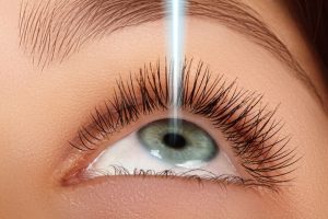 laser surgery lasik laser and PRK