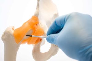 Arthroscopic Surgery