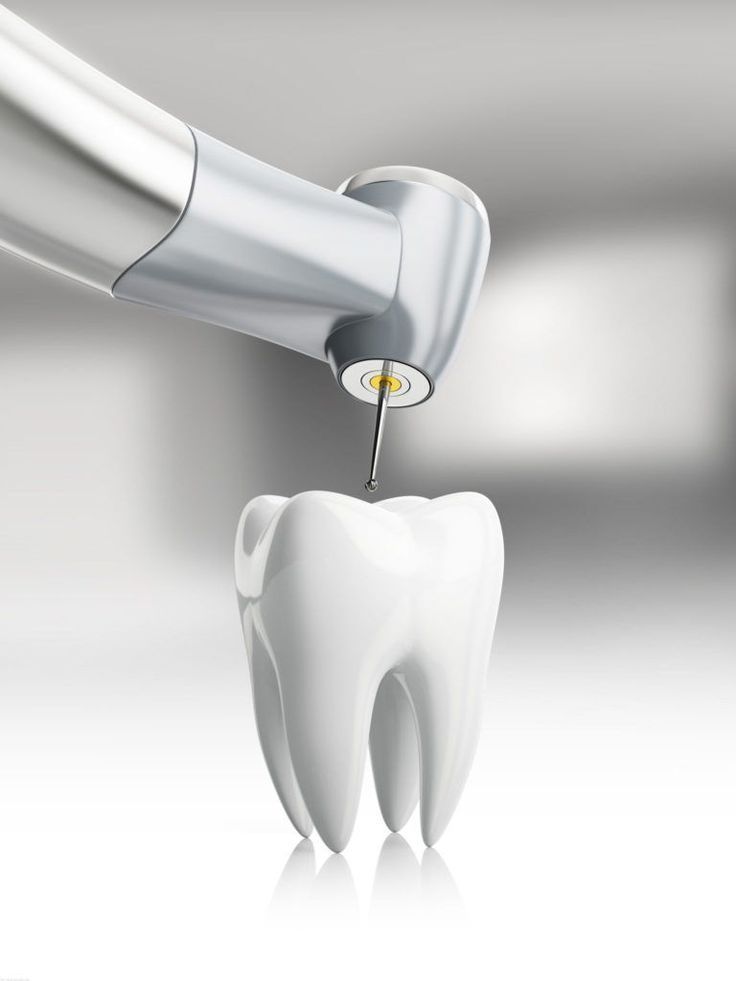 Comprehensive Root Canal Care