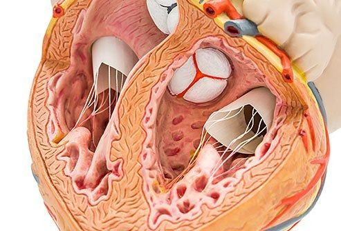 cardiac ablation