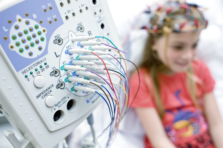 Eeg (Electroencephalography)