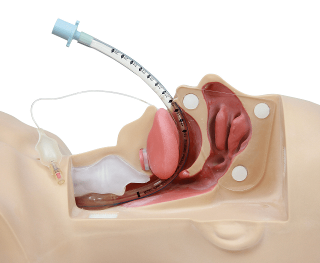 Gastroscopy