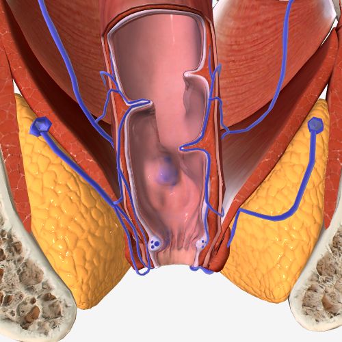 Hemorrhoidectomy