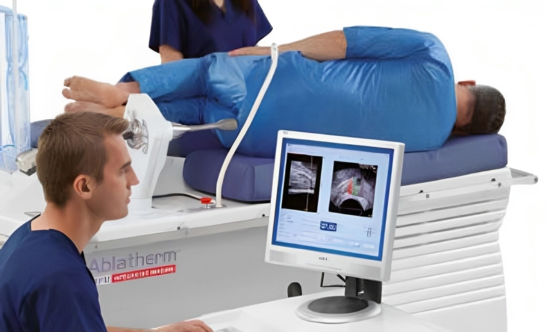 High Intensity Focused Ultrasound Ablation (HIFU)