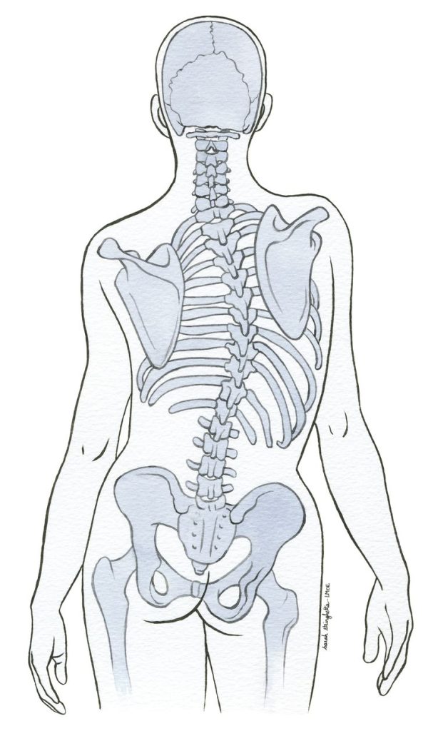 Surgical Treatment Of Scoliosis