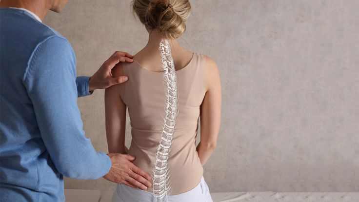 Surgical Treatment Of Scoliosis