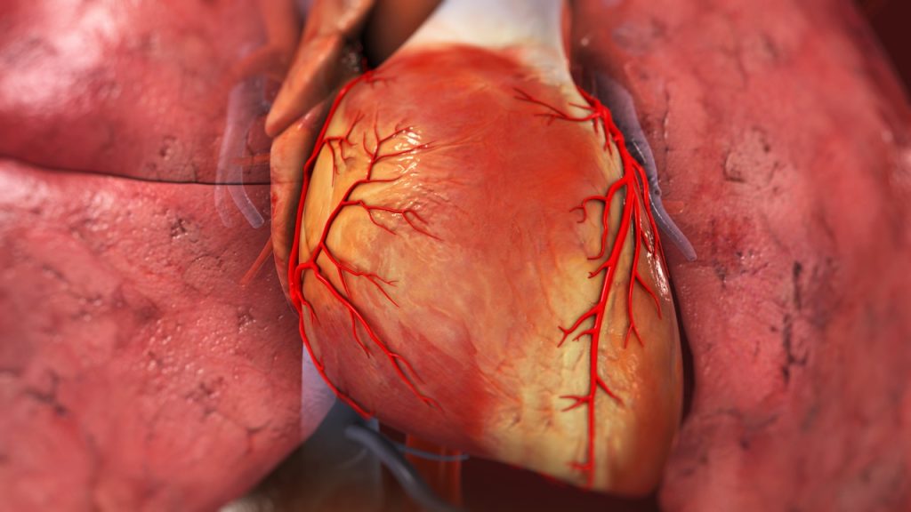 Coronary Angiography