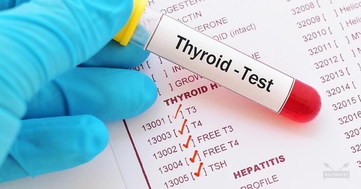 Thyroid Function Tests (İncluding T3, T4, TSH)