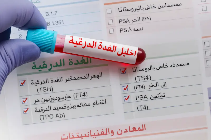 اختبارات لوحة الغدة الدرقية