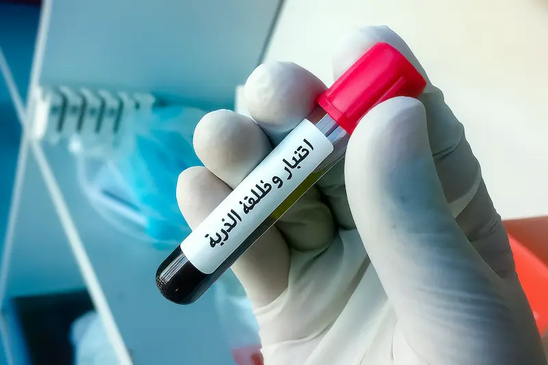 فحوصات وظائف الغدة الدرقية ( T3, T4, TSH)