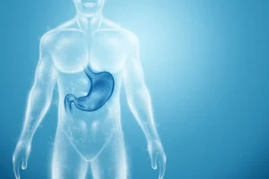 استئصال المعدة في تركيا