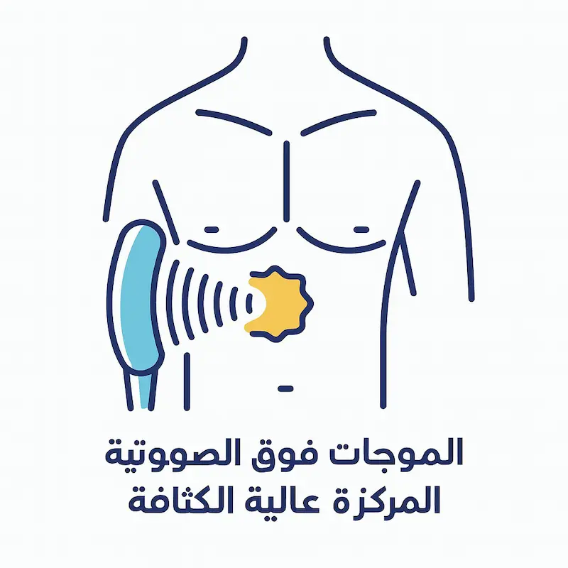 الموجات فوق الصوتية المركزة عالية الكثافة - HIFU