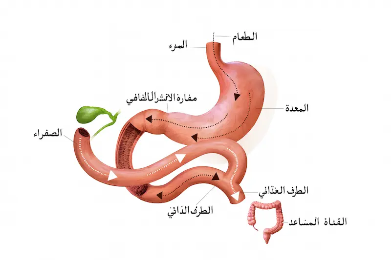 التمثيل الغذائي الجراحة التكلفة تركيا