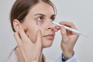 Blepharoplasty in Turkey