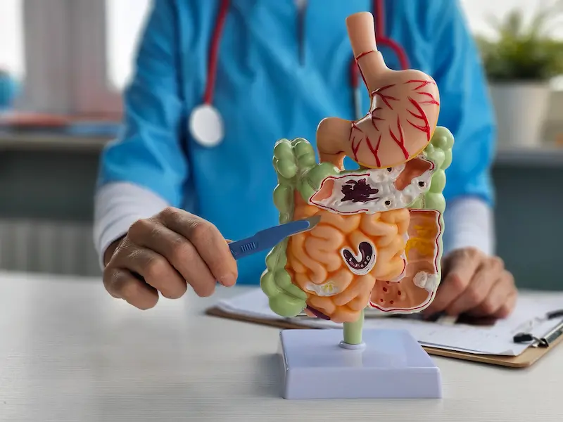 Doctor Consultation before Small Intestine Resection in Turkey