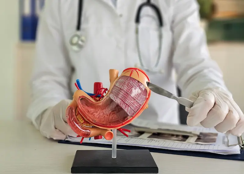 Gastric Sleeve Cost Turkey