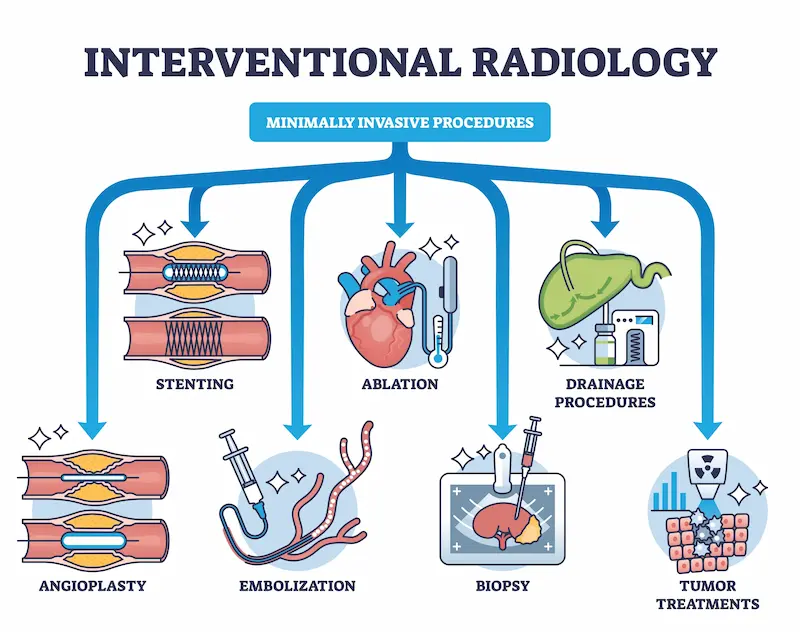 Interventional Radiology