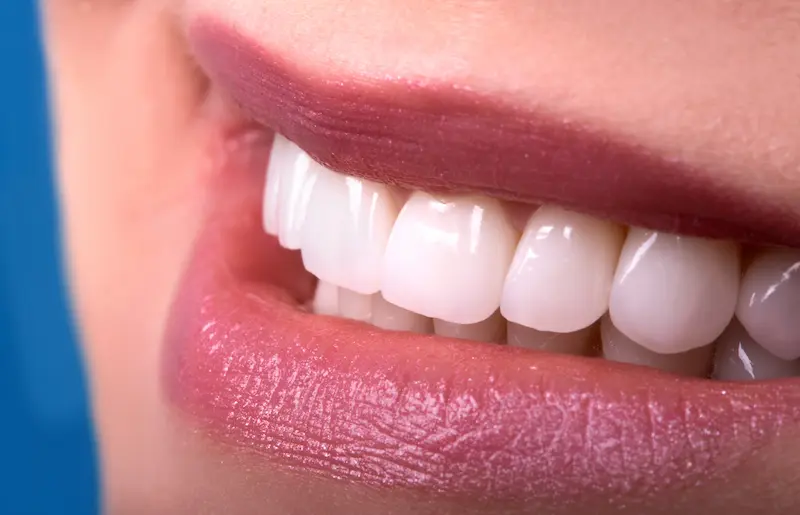 خدمات طب الأسنان التجميلي