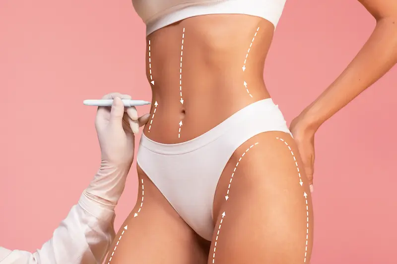 Liposuction in Turkey