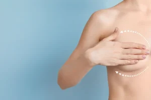 Lumpectomy in Turkey