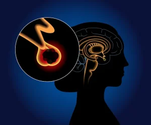 Pituitary treatment in Turkey