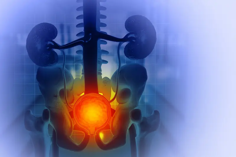 Prostate Cancer