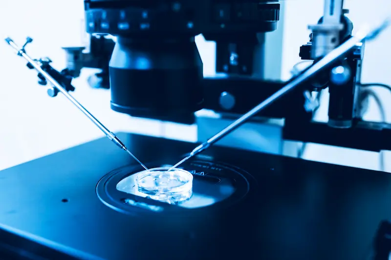 تكلفة علاج ICSI في تركيا