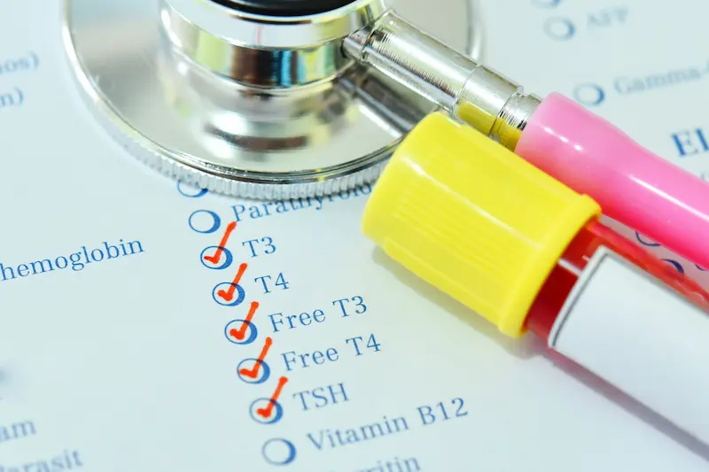 Thyroid function tests