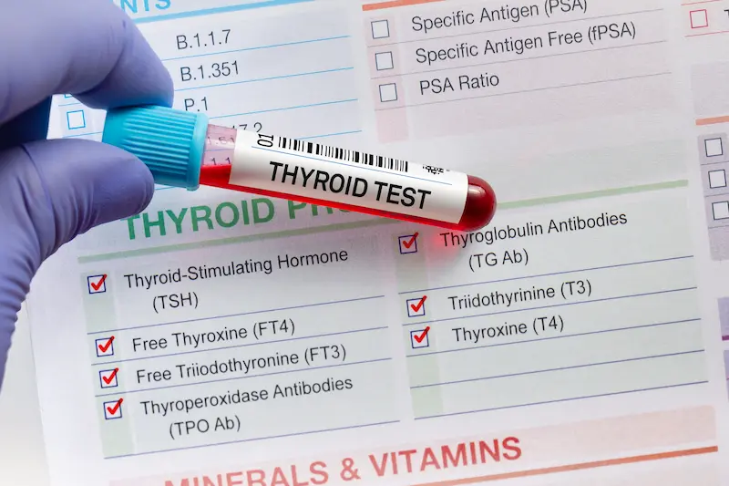 Thyroid Panel Tests