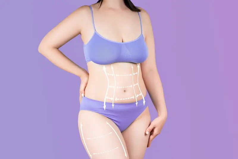 Tummy Tuck Cost Turkey