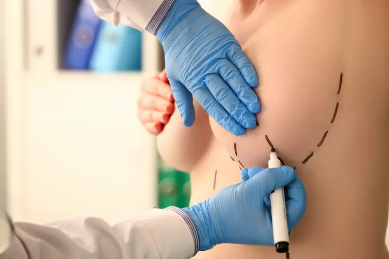 Types of Breast Augmentation