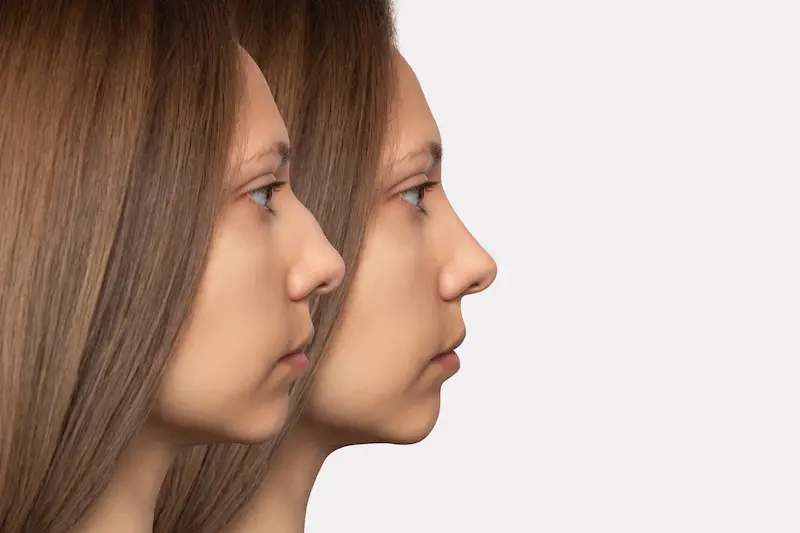 Before and after treatment