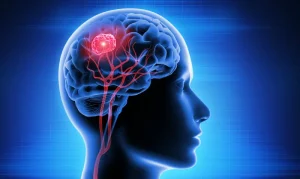 Brain Tumor Surgery in Turkey
