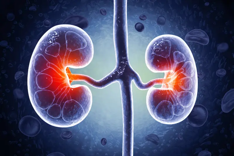 Kidney Transplant in Turkey