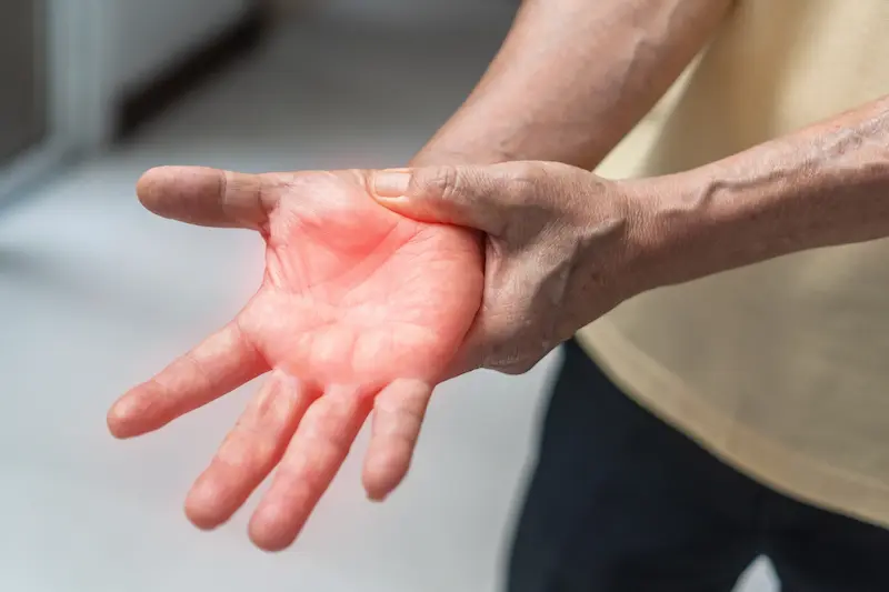 Treatment of Polyneuropathy in Turkey