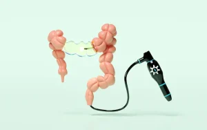 Colonoscopy in Turkey