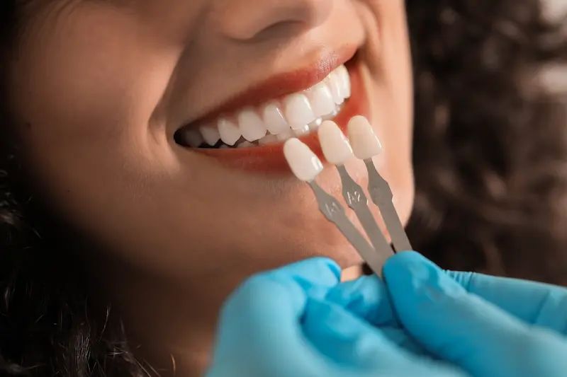 Dental Veneers in Turkey