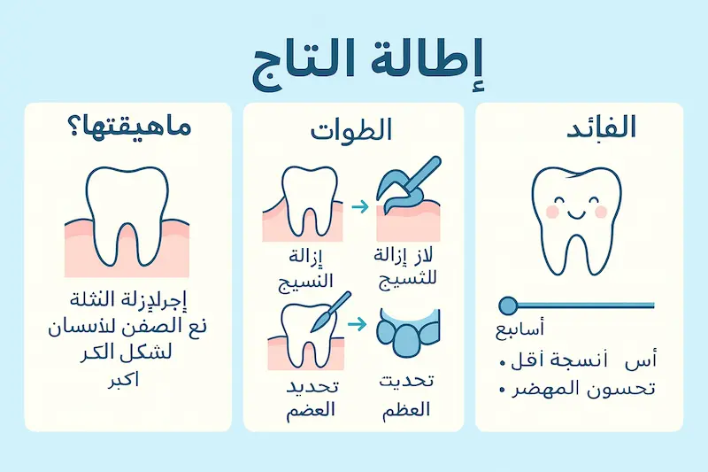 ما هو إطالة التاج