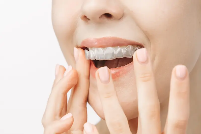 Orthodontics Cost