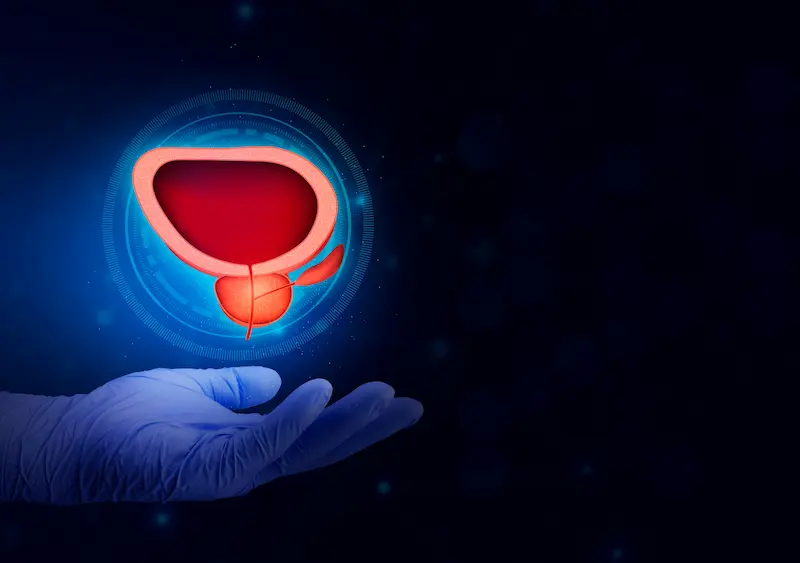 Prostate Cancer Treatment in Turkey