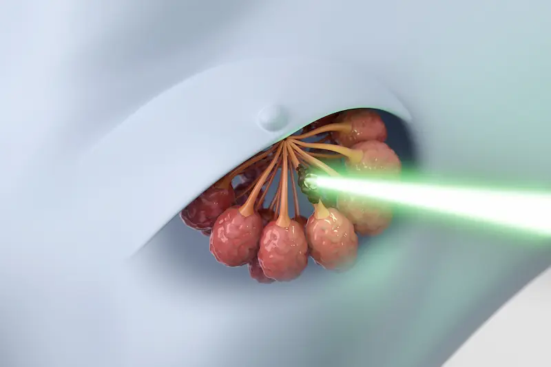 Radiotherapy in Turkey