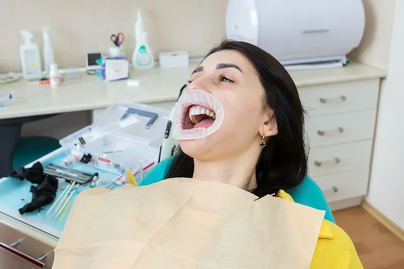 Restorative Dentistry Cost