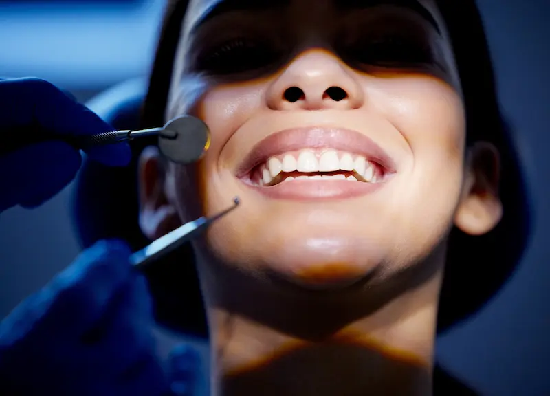 Teeth Cleaning and Scaling in Turkey