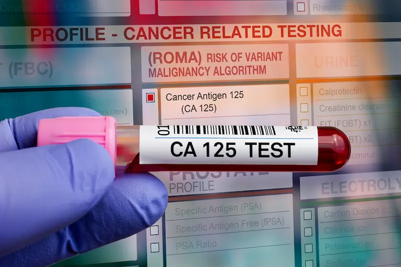 Tumor Marker Blood Test Cost