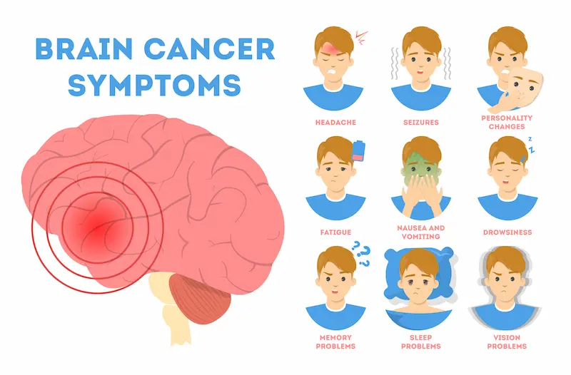 Brain Cancer Symptoms