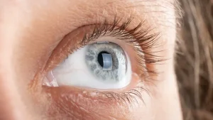 Corneal Transplant in Turkey