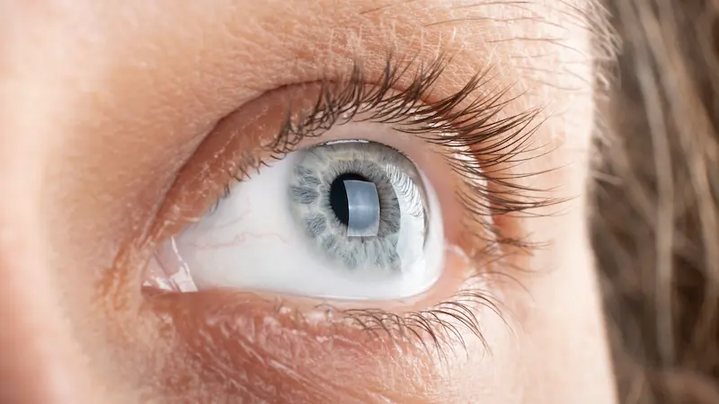 Corneal Transplant in Turkey