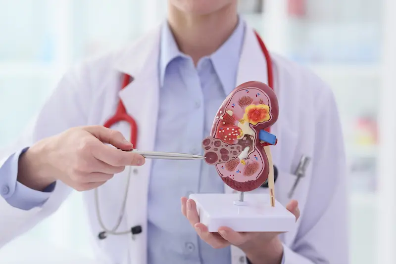 Doctor Consultation Before Kidney Transplant in Turkey